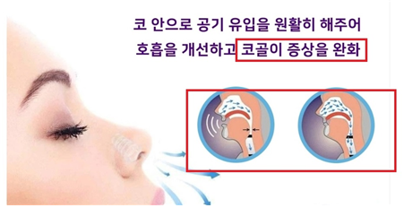 의료기기 오인 우려 광고